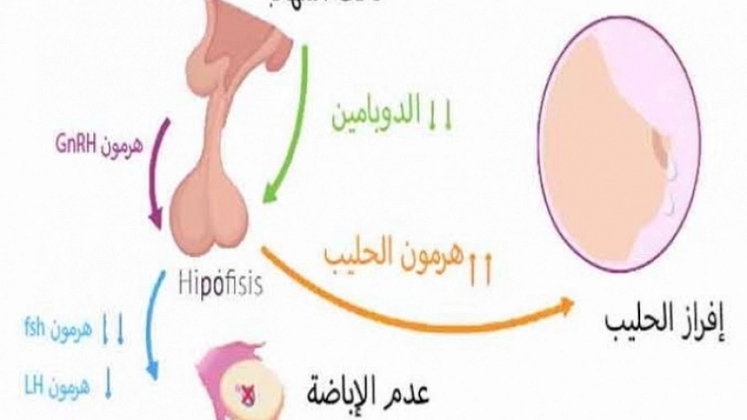 ما هي علامات ارتفاع هرمون الحليب في الجسم؟