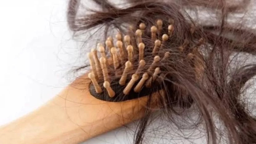 ما هي اسباب تساقط الشعر؟ وما أفضل الطرق العلاجية؟