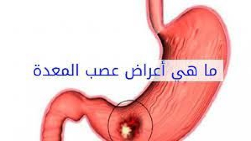 أهم اعراض عصب المعدةوأسبابه وطرق علاجه