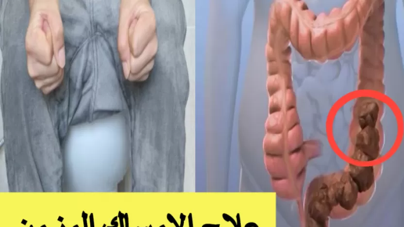 أضرار الإمساك المزمن وطرق الوقاية منها