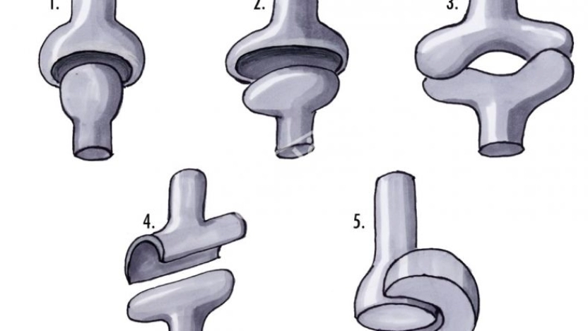 انواع المفاصل في الجسم وخصائصها