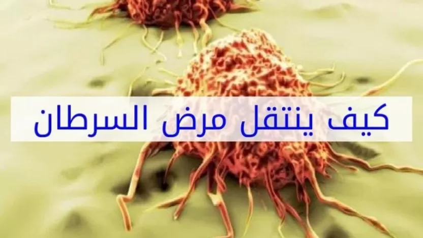 كيف ينتقل مرض السرطان؟ هل مرض السرطان معدٍ؟