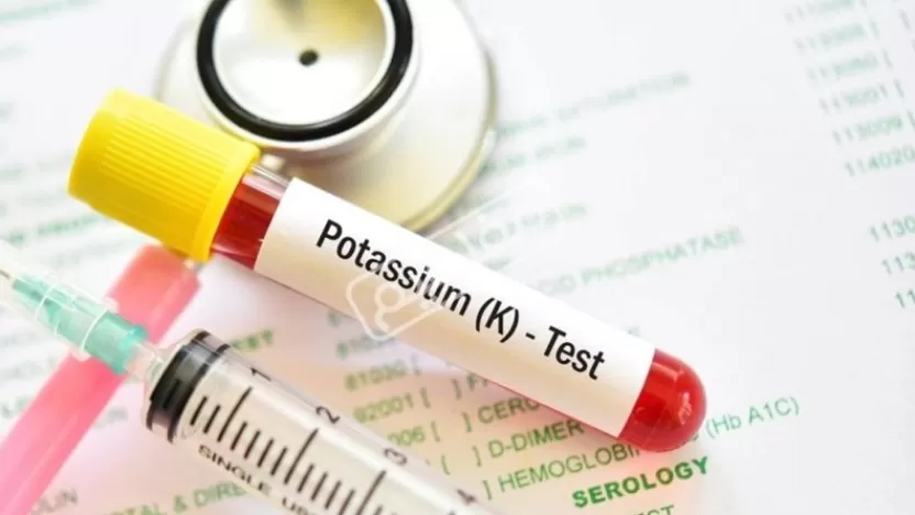 أسباب وأعراض ارتفاع نسبة البوتاسيوم في الدم