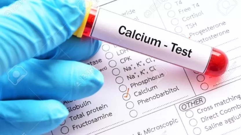 أسباب حدوث فرط كالسيوم الدم وطرق الوقاية منه