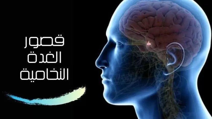 أعراض قصور الغدة النخامية وطرق علاجه