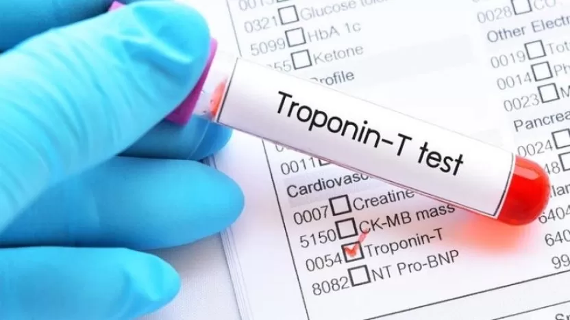 دواعي إجراء تحليل تروبونين - Troponin Test