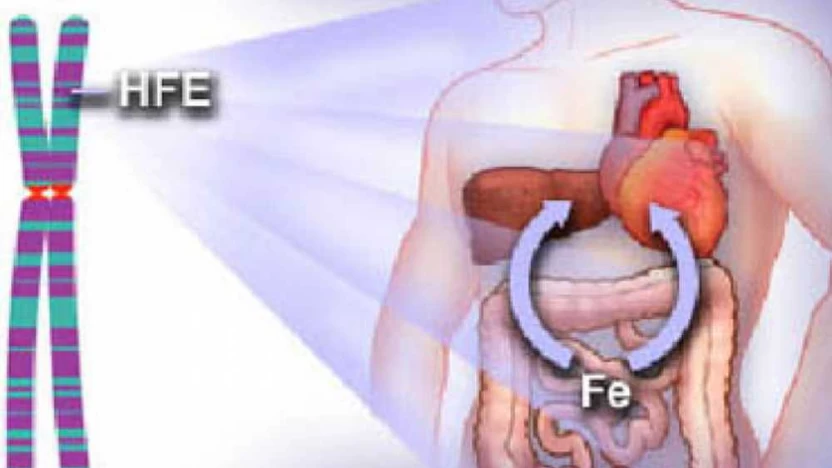 أهم 3 طرق لعلاج داء ترسب الأصبغة الدموية