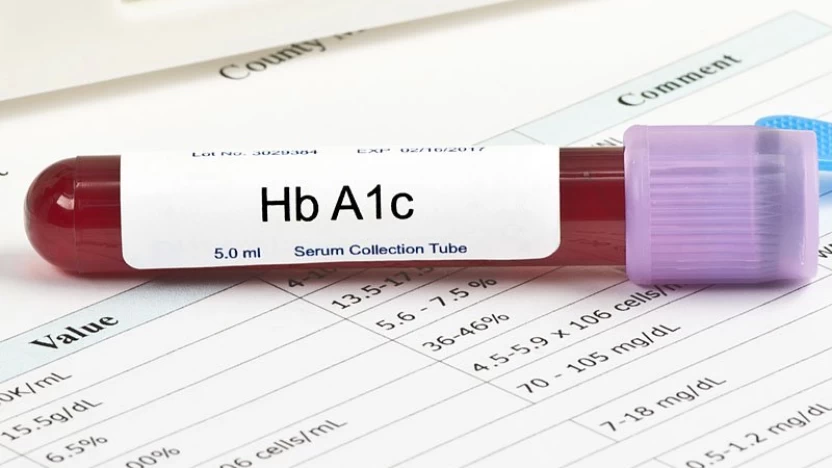 مخاطر تحليل السكر التراكمي HbA1c Test ونتائجه