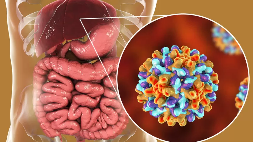 التهاب الكبد ب الأسباب والأعراض وطرق الوقاية