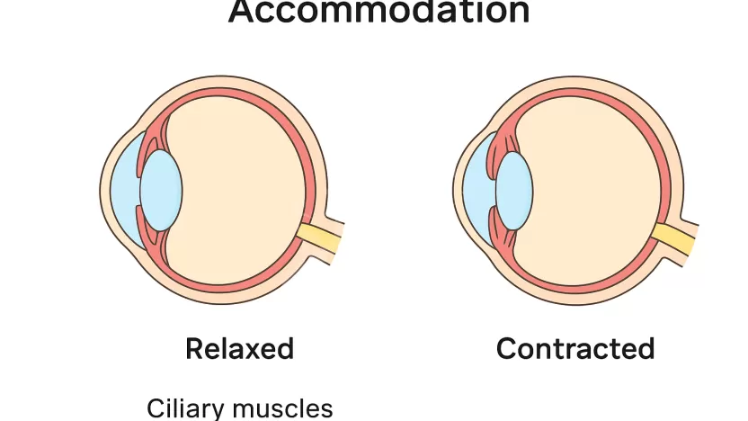 يتغير البعد البؤري لعدسة العين عندما تنقبض، أو تنبسط العضلات المحيطة بالعين