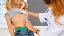أسباب انحناء العمود الفقري عند الاطفال وطرق علاجه