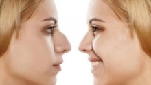 أبرز مخاطر وأضرار عملية تجميل الأنف