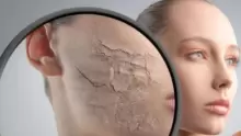 ما هي أضرار المكياج