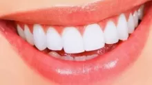 أنواع تركيبات الأسنان