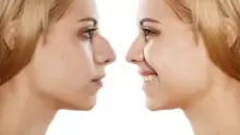 وصفات طبيعية لتصغير الأنف والشفايف