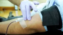 أبرز فوائد ابرة البلازما