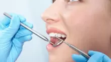 أبرز مشاكل الأسنان وطرق العلاج