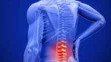 أفضل طرق علاج التهاب النخاع الشوكي بالحجامة