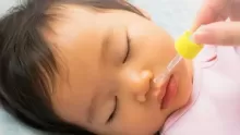 علاج انسداد الانف عند الرضع بالطرق الطبيعية والدوائية
