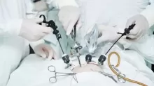 أبرز إيجابيات وسلبيات الجراحة باستخدام المنظار