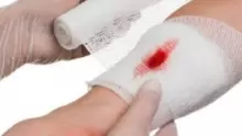 الاسعافات الاولية للجروح