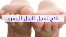 علاج تنميل الرجلين.. 4 طرق طبيعية للتخلص من التنميل