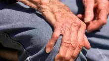 ما هو مرض شلل الرعاش؟ أسبابه وطرق علاجه؟
