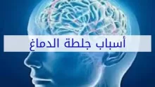 ما هي آثار جلطة الدماغ على الجسم؟