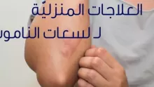 علاج قرصة الناموس بمكونات من المنزل