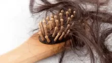 أسباب تساقط الشعر بكثرة عند النساء والرجال والأطفال