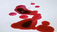 ما هو لون دم الإجهاض؟ وما هي الأعراض المصاحبة للإجهاض؟