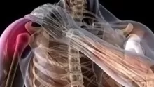 أهم أعراض خلع الكتف وأسبابه وطرق العلاج