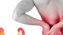 تعرف على أعراض حصى الكلى وطرق علاجها