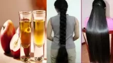 فوائد خل التفاح للشعر وكيفية استخدامه