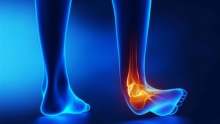 أسباب التواء الكاحل بالقدمين وطرق علاجه