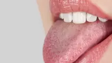 أسباب وأعراض مرض سرطان اللسان وعلاجه
