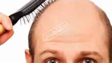 اعشاب عطرية للشعر لعلاج التساقط