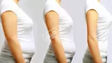 كيف أحرق الدهون بسرعة لمنع زيادة وزن الجسم؟