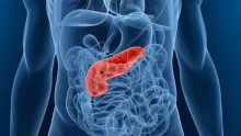 علاج التهاب البنكرياس الحاد والمزمن، وما هي أسبابه وأعراضه؟