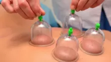 ما هو افضل وقت للحجامة للرجال؟ وما هي أهم فوائدها وأضرارها؟