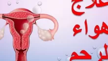 كيفية علاج هواء الرحم بشكل طبيعي ؟ وما هي أهم أسبابه؟؟