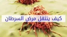 كيف ينتقل مرض السرطان؟ هل مرض السرطان معدٍ؟