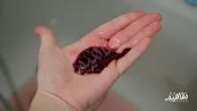 ما هي أسباب دم الدورة اسود وثقيل للمتزوجه وطرق علاجه؟