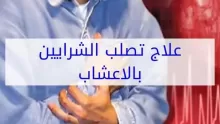 علاج تصلب الشرايين لمرضى السكري ومعلومات هامة عن تصلب الشرايين