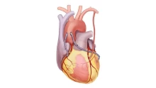 أسباب إجراء جراحة مجازة الشريان التاجي (CABG)