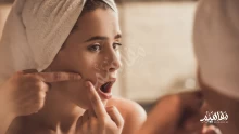 أحدث طرق طبيعية لعلاج حب الشباب في المنزل والتخلص منه نهائيا