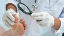 طرق علاج فطريات الاظافر بوصفات طبيعية مجربة ومضمونة 100%