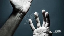 عدد حالات متلازمة اليد الغريبة: أسبابها وأعراضها وطرق علاجها