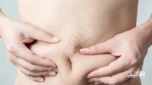 أسرع طرق التخلص من الكرش للنساء نهائيًا بطرق مجربة ومضمونة 100%