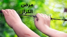 هل مرض الكزاز مميت؟ ما هي أسباب وأعراض الكزاز؟